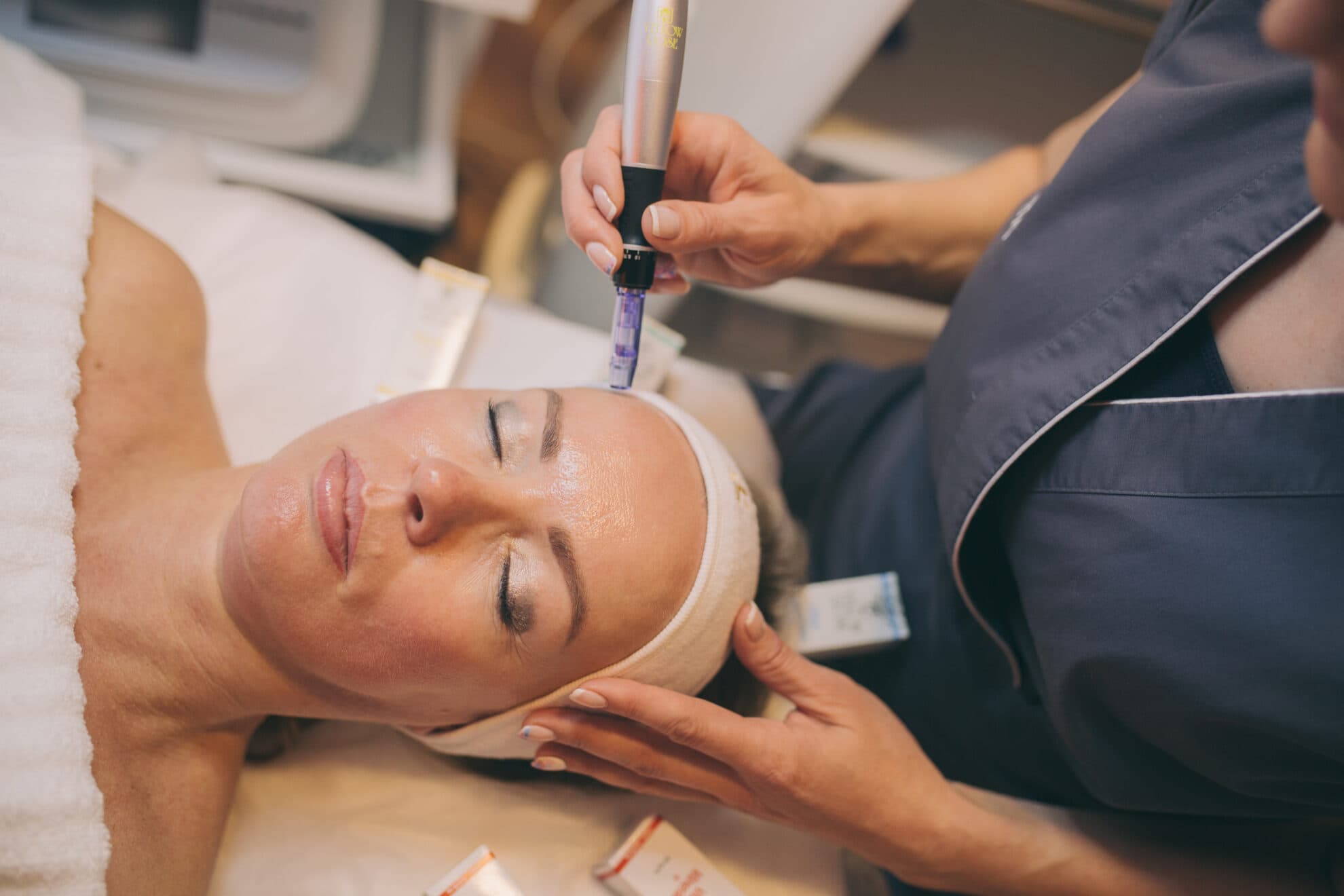 Procedūra Acne skartai un problemātiskai sejas ādai